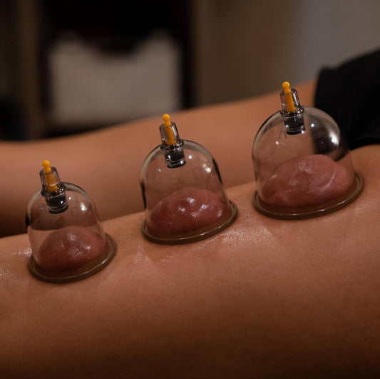18pcs Suction Vacuum Cupping Set